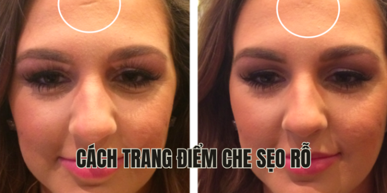 cách trang điểm che sẹo rỗ